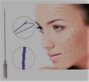 Facelift surgery in Egypt