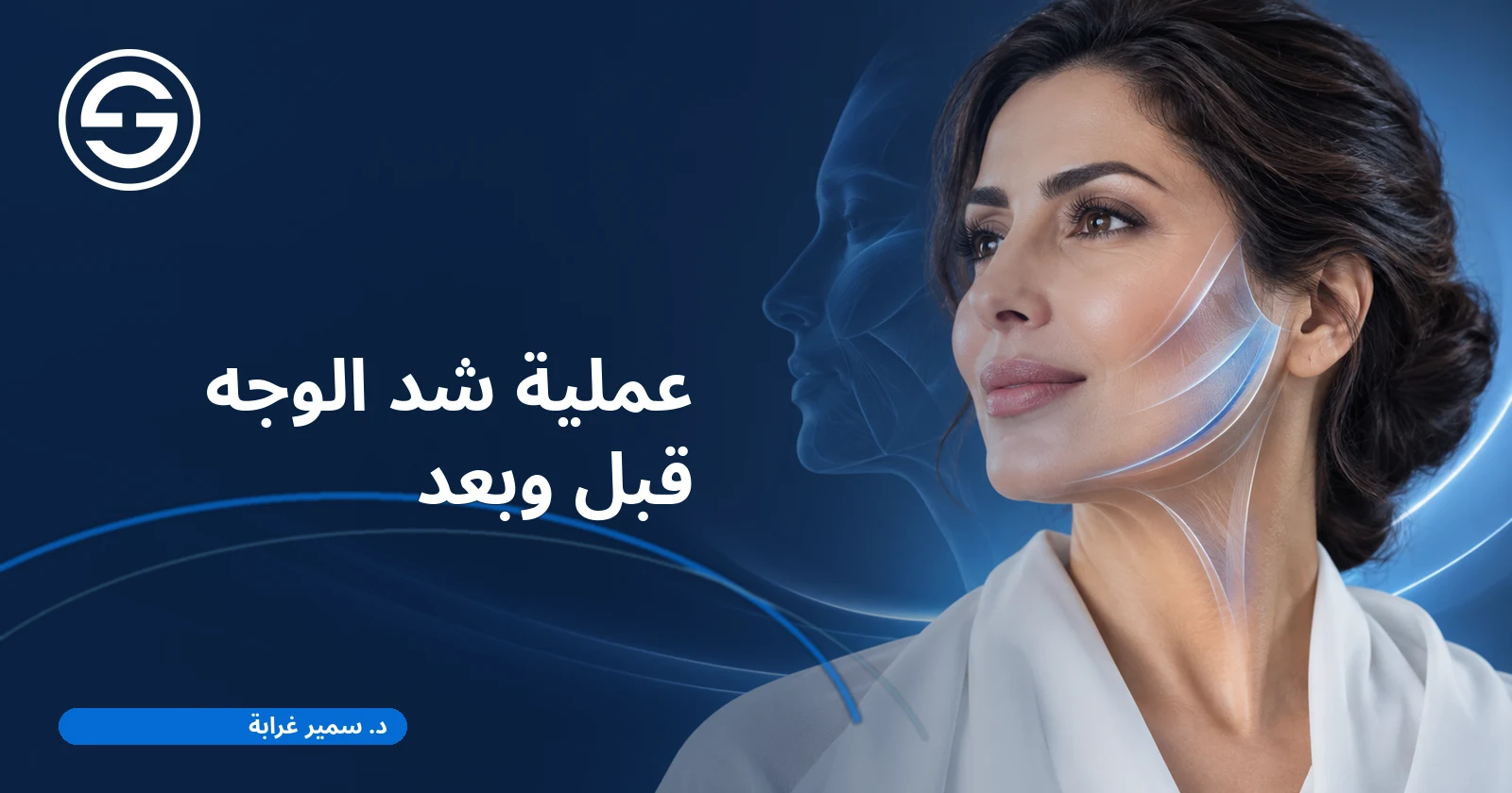 عملية شد الوجه قبل وبعد