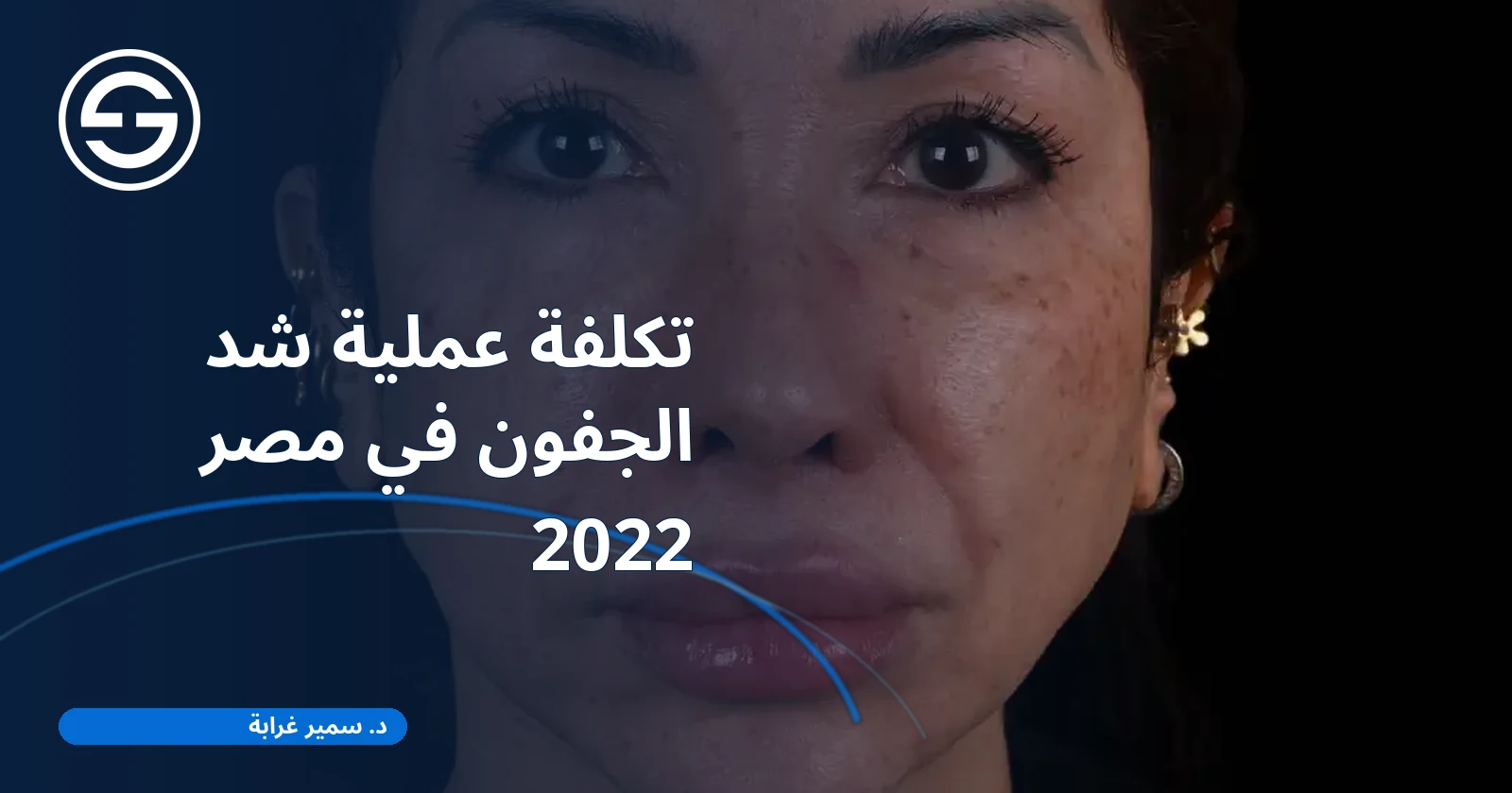 تكلفة عملية شد الجفون في مصر 2022