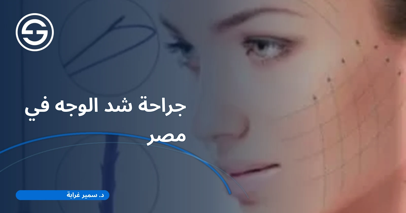 جراحة شد الوجه في مصر